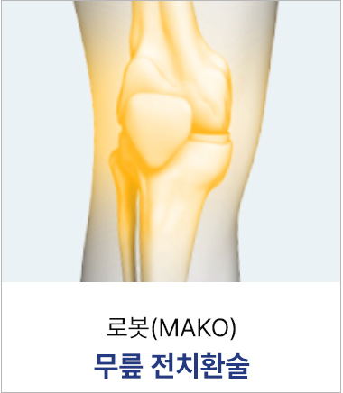 로봇(MAKO)무릎 전치환술